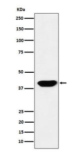 Anti-Islet1 Monoclonal Antibody Boster Bio