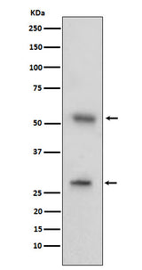 Anti-CD97 Rabbit Monoclonal Antibody Boster Bio