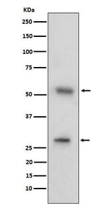 Anti-CD97 Rabbit Monoclonal Antibody Boster Bio