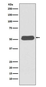 Anti-LSP1 Rabbit Monoclonal Antibody Boster Bio