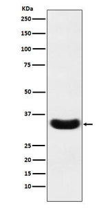 Anti-Scramblase 1 Rabbit Monoclonal Antibody Boster Bio