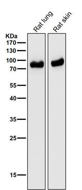 Anti-CD105 Rabbit Monoclonal Antibody Boster Bio