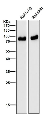 Anti-CD105 Rabbit Monoclonal Antibody Boster Bio