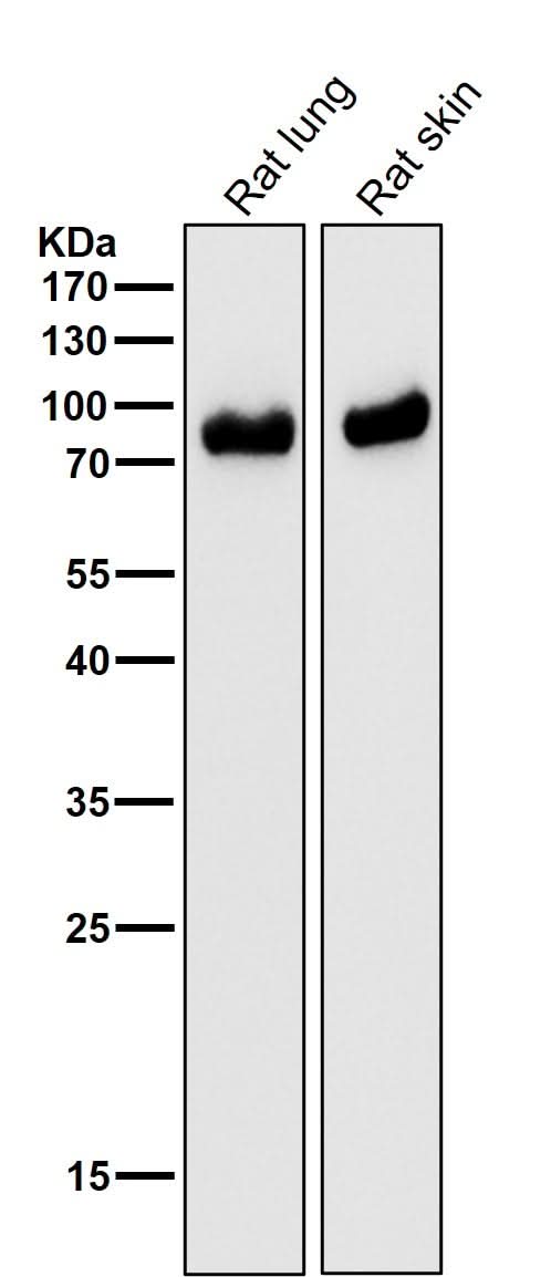 Anti-CD105 Rabbit Monoclonal Antibody Boster Bio
