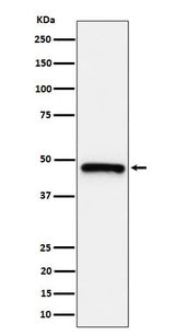 Anti-ING1 Rabbit Monoclonal Antibody Boster Bio