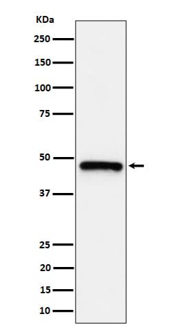 Anti-ING1 Rabbit Monoclonal Antibody Boster Bio
