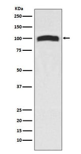 Anti-VAV2 Rabbit Monoclonal Antibody Boster Bio