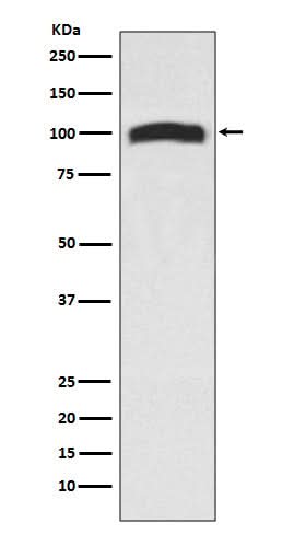 Anti-VAV2 Rabbit Monoclonal Antibody Boster Bio