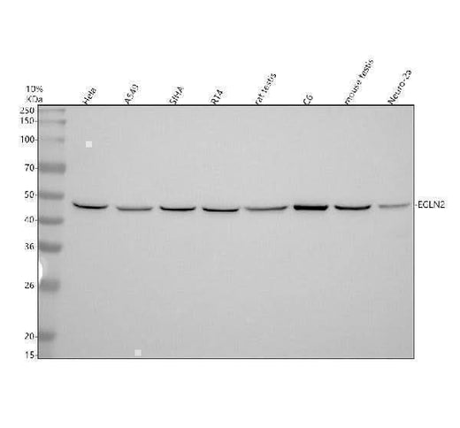 Anti-PHD1/prolyl hydroxylase Rabbit Monoclonal Antibody Boster Bio
