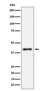 Anti-IL15RA Rabbit Monoclonal Antibody Boster Bio