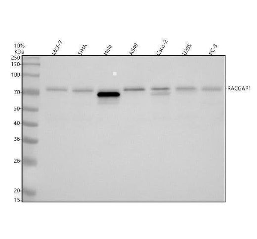 Anti-RGAP1 Rabbit Monoclonal Antibody Boster Bio