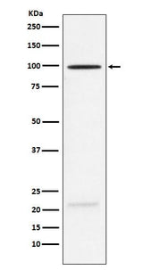 Anti-MAG Rabbit Monoclonal Antibody Boster Bio