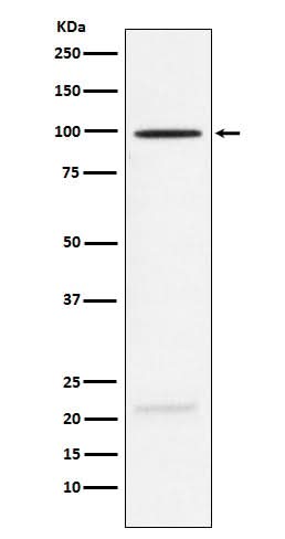 Anti-MAG Rabbit Monoclonal Antibody Boster Bio