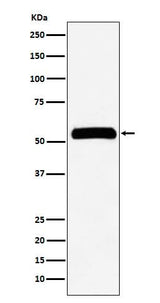Anti-IMPDH2 Rabbit Monoclonal Antibody Boster Bio