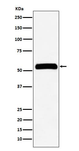 Anti-IMPDH2 Rabbit Monoclonal Antibody Boster Bio