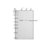 Anti-Calcineurin A Rabbit Monoclonal Antibody Boster Bio
