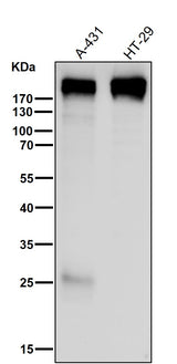Anti-Collagen XVII Rabbit Monoclonal Antibody Boster Bio