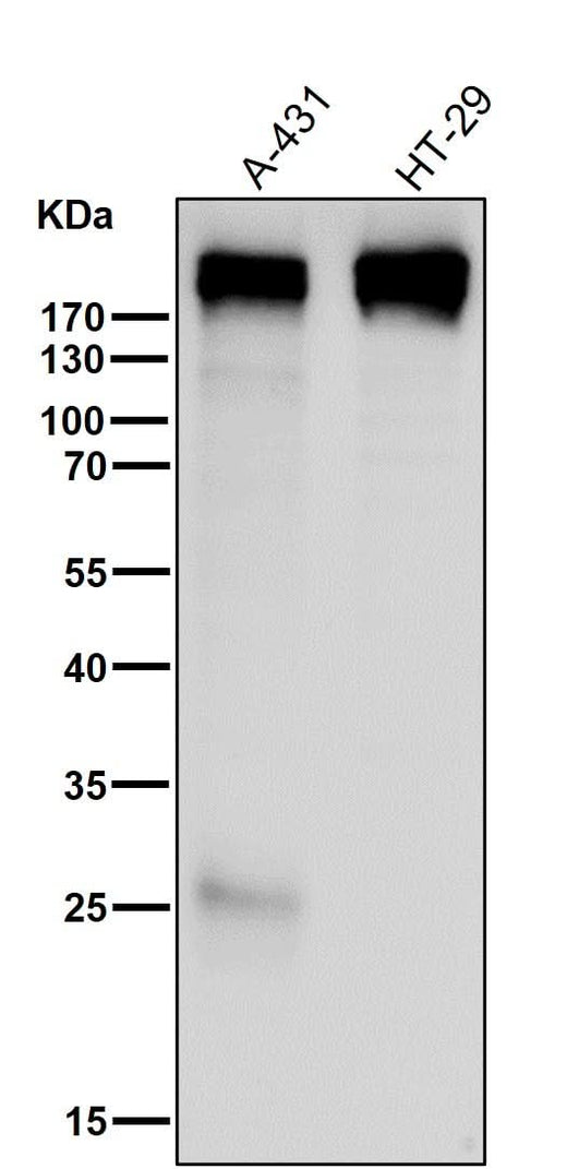 Anti-Collagen XVII Rabbit Monoclonal Antibody Boster Bio