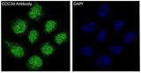 Anti-CDC34/Ubch3 Rabbit Monoclonal Antibody Boster Bio