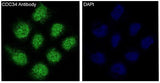 Anti-CDC34/Ubch3 Rabbit Monoclonal Antibody Boster Bio