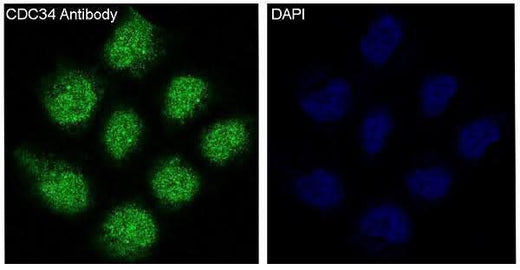 Anti-CDC34/Ubch3 Rabbit Monoclonal Antibody Boster Bio