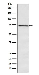 Anti-DOK1 Rabbit Monoclonal Antibody Boster Bio