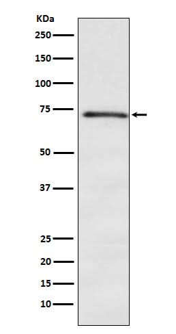 Anti-DOK1 Rabbit Monoclonal Antibody Boster Bio