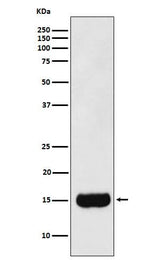 Anti-MSMB Monoclonal Antibody Boster Bio