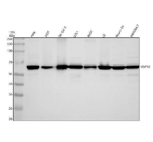 Anti-USP14 Rabbit Monoclonal Antibody Boster Bio