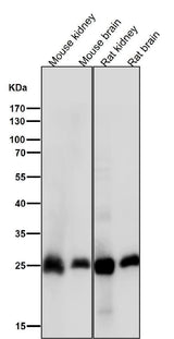 Anti-Calbindin CALB1 Rabbit Monoclonal Antibody Boster Bio