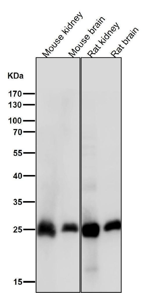 Anti-Calbindin CALB1 Rabbit Monoclonal Antibody Boster Bio