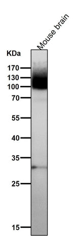 Anti-mGluR1 GRM1 Rabbit Monoclonal Antibody Boster Bio