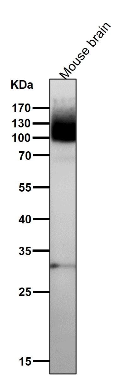 Anti-mGluR1 GRM1 Rabbit Monoclonal Antibody Boster Bio