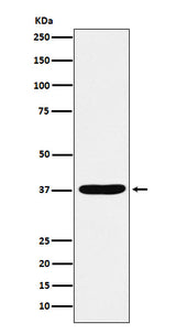 Anti-AKR1C1 / AKR1C2 Rabbit Monoclonal Antibody Boster Bio