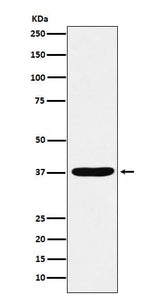 Anti-AKR1C1 / AKR1C2 Rabbit Monoclonal Antibody Boster Bio