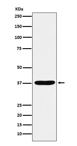 Anti-AKR1C1 / AKR1C2 Rabbit Monoclonal Antibody Boster Bio