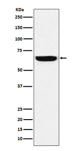Anti-GBP1 Rabbit Monoclonal Antibody Boster Bio