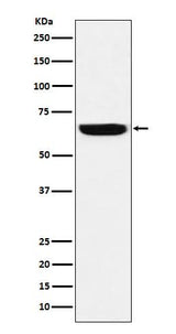Anti-GBP1 Rabbit Monoclonal Antibody Boster Bio