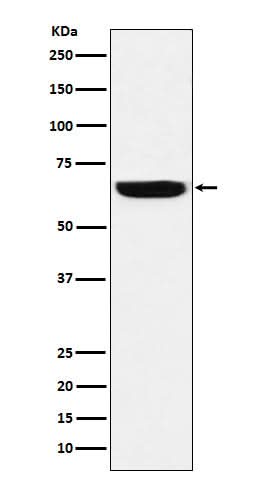 Anti-GBP1 Rabbit Monoclonal Antibody Boster Bio