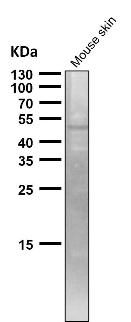 Anti-TRAF4 Rabbit Monoclonal Antibody Boster Bio
