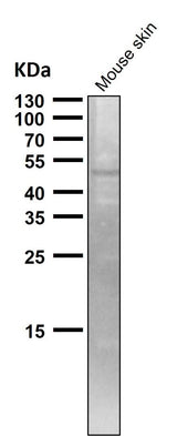 Anti-TRAF4 Rabbit Monoclonal Antibody Boster Bio