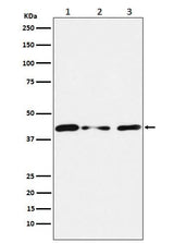 Anti-Tin2 Rabbit Monoclonal Antibody Boster Bio