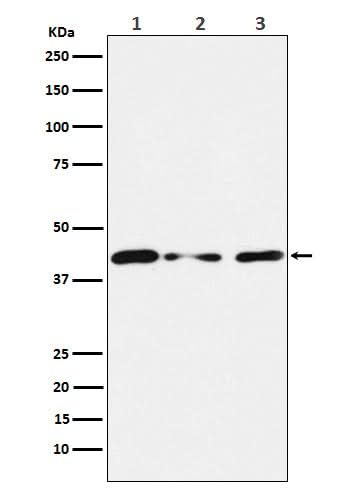Anti-Tin2 Rabbit Monoclonal Antibody Boster Bio
