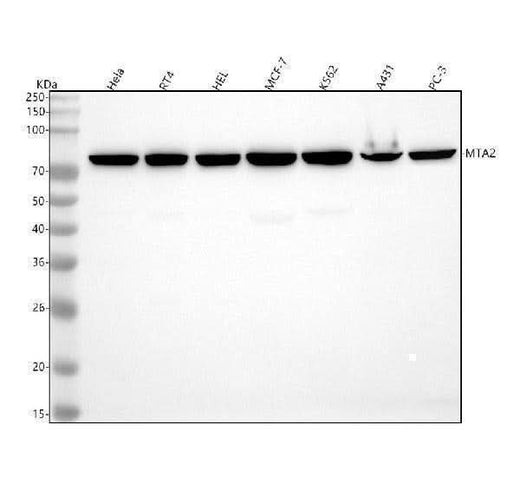 Anti-MTA2 Monoclonal Antibody Boster Bio