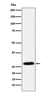 Anti-GSC Rabbit Monoclonal Antibody Boster Bio