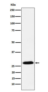 Anti-GSC Rabbit Monoclonal Antibody Boster Bio