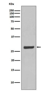 Anti-AQP5 Rabbit Monoclonal Antibody Boster Bio