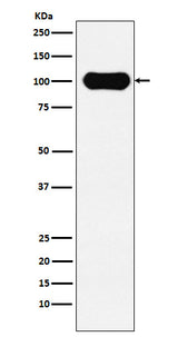 Anti-FE65 Rabbit Monoclonal Antibody Boster Bio