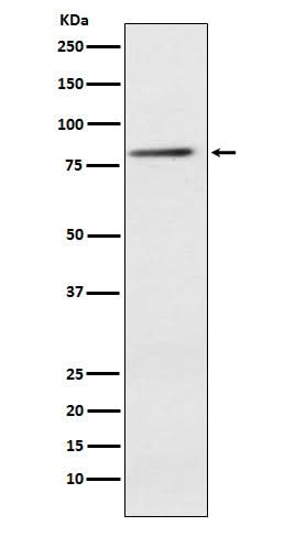 Anti-ELMO1 Rabbit Monoclonal Antibody Boster Bio