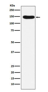 Anti-Desmoglein 3 Rabbit Monoclonal Antibody Boster Bio
